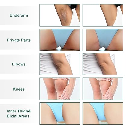 FAMIROSA Intimate Area Dark Spot Corrector: Underarm Cream for Armpit, Knees, Elbows, inner Thigh, Private Parts - Intimate Skin Cream 50 ml