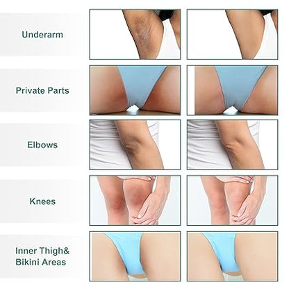 FAMIROSA Intimate Area Dark Spot Corrector: Underarm Cream for Armpit, Knees, Elbows, inner Thigh, Private Parts - Intimate Skin Cream 50 ml